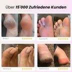 PediPro Ultra© - Elektrischer Hornhautentferner