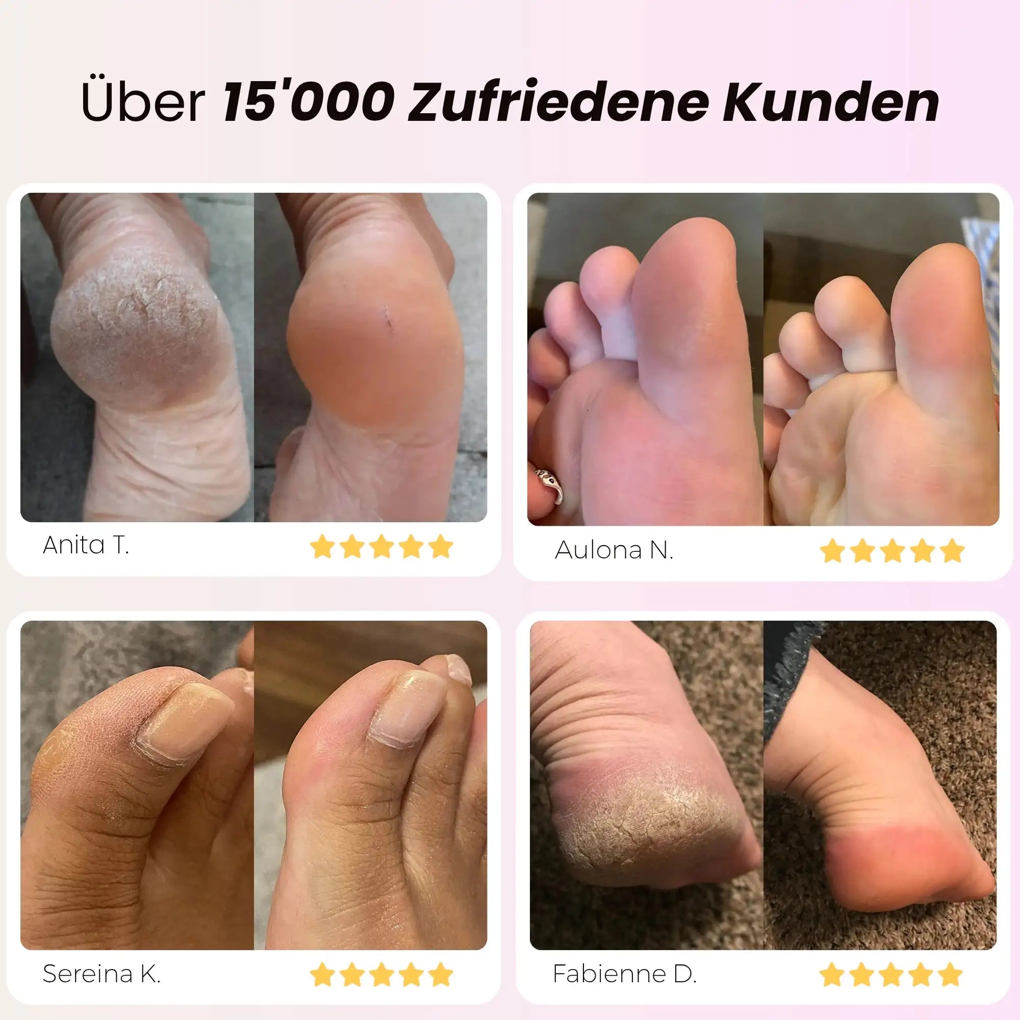 PediPro Ultra© - Elektrischer Hornhautentferner